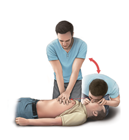 심폐소생술순서방법