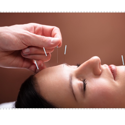 구안와사 치료기간 과정 방법