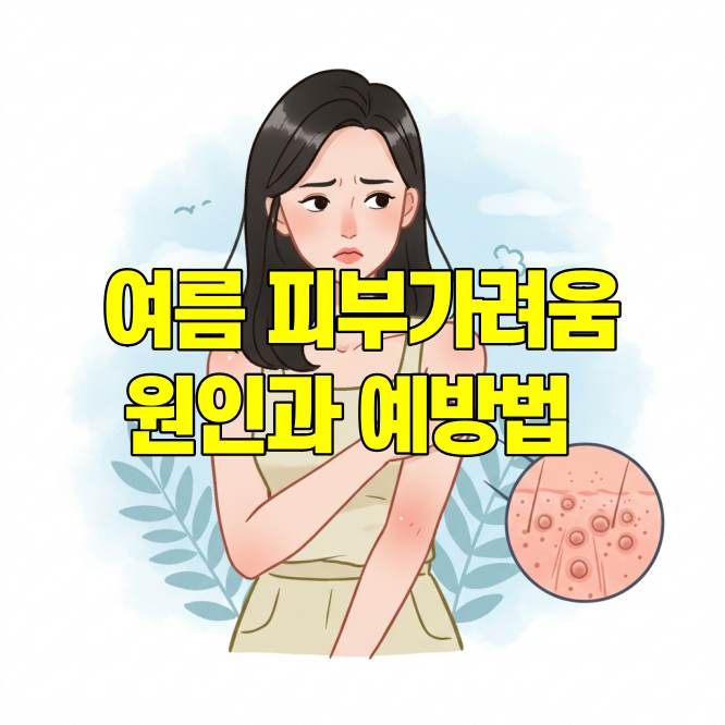 여름 피부 가려움증 원인과 예방법 총정리