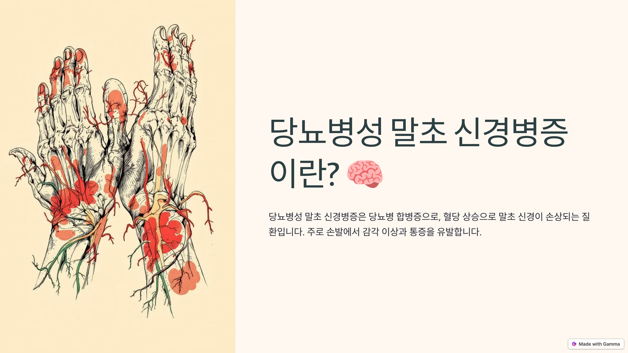 당뇨병성 말초 신경병증