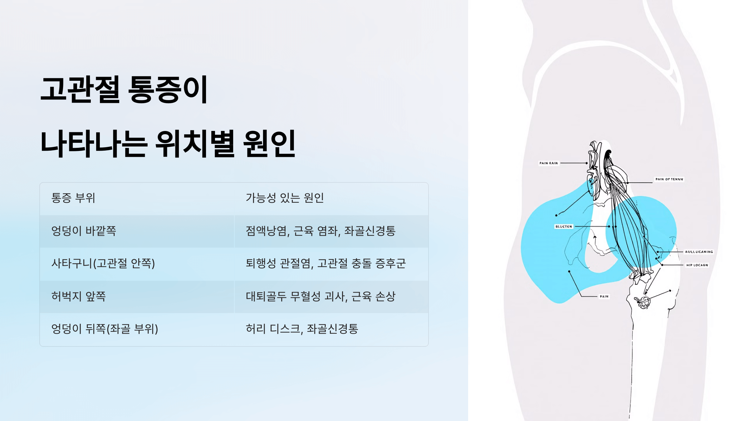 고관절 사진입니다.