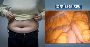여름철 피부관리와 다이어트&amp;#44; 함께 완성하는 비법