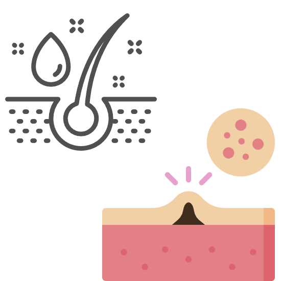 소극성 속모증의 원인과 증상