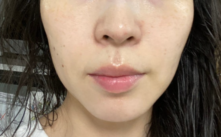 쿼드쎄라 내돈내산 효과