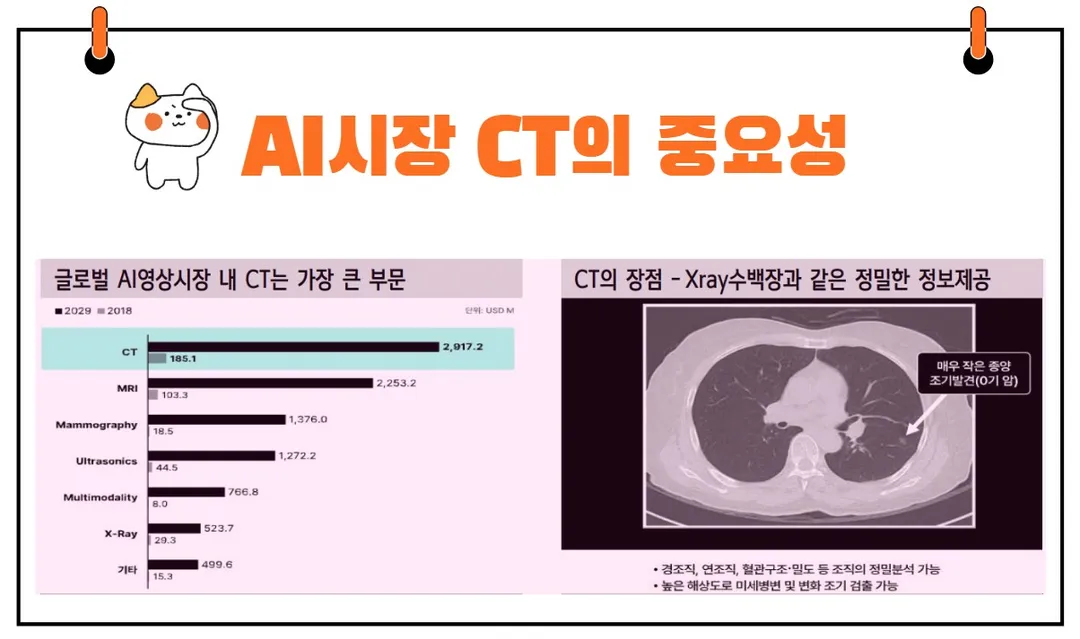 의료AI CT 비중