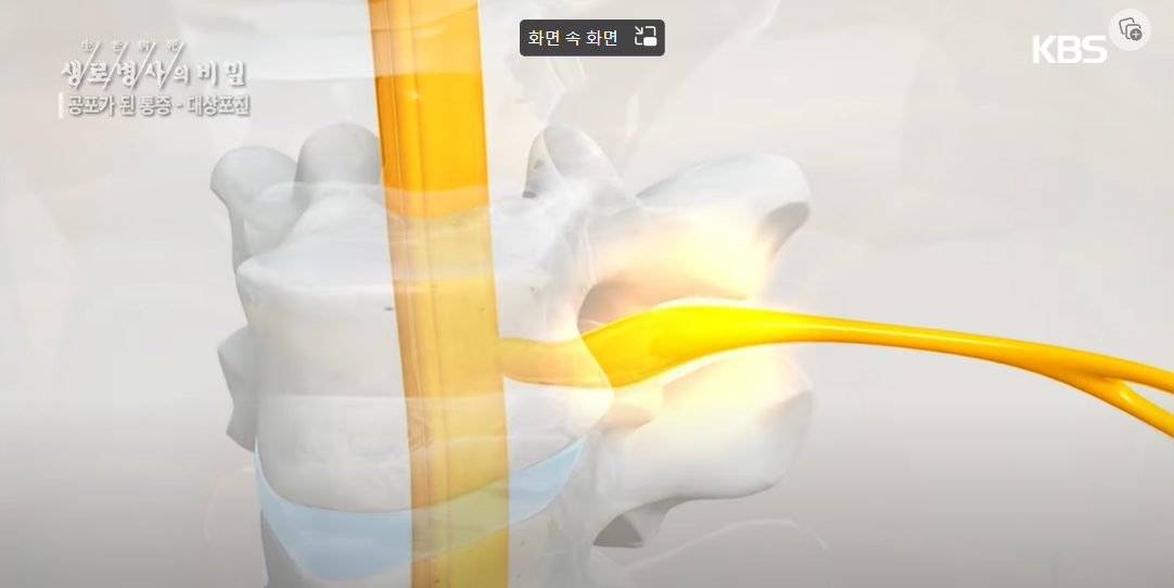 대상포진 증상, 치료, 예방접종