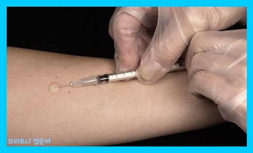 면역력이란 사진