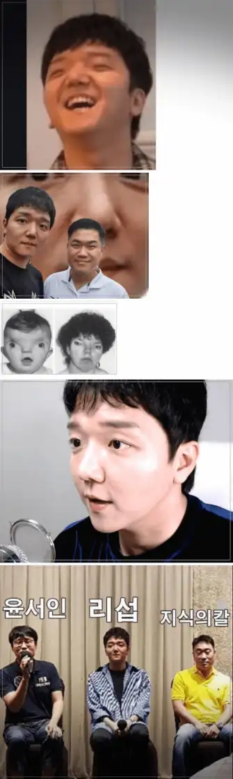 리섭의-얼굴논란