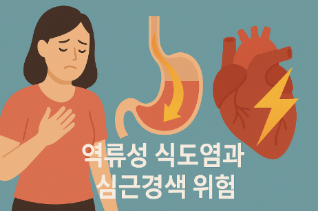 역류성 식도염, 심근경색 위험