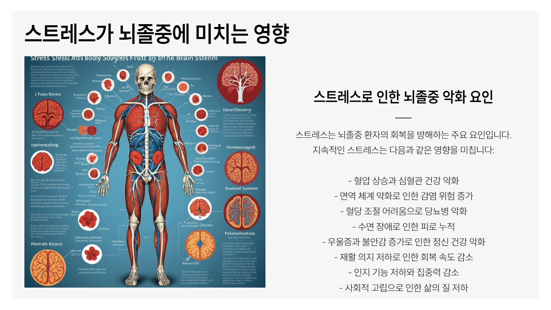 뇌졸중과 스트레스, 심리적 관리 방법
