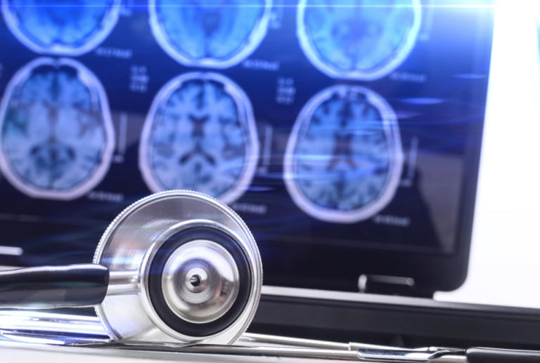 뇌에 좋은 습관, 뇌에 나쁜 습관