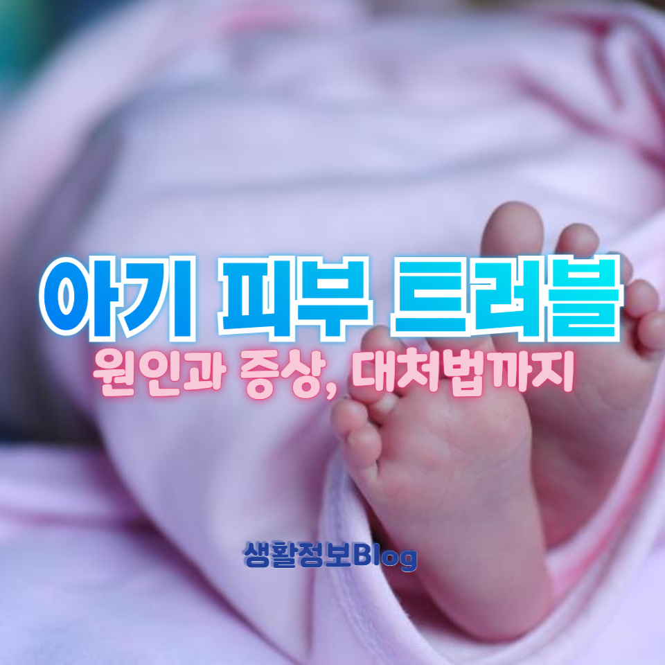 아기 피부 트러블