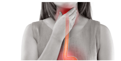 역류성 식도염의 증상과 예방 및 관리방법