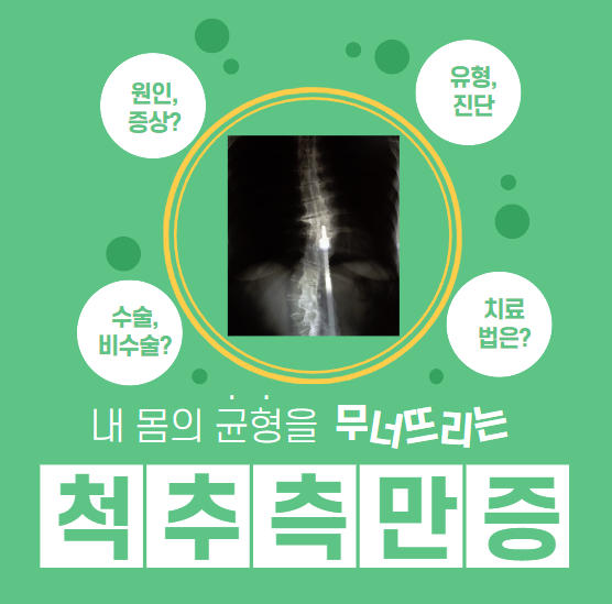 척추측만증과 함께하는 삶, 척추측만증에 대해 알아보자