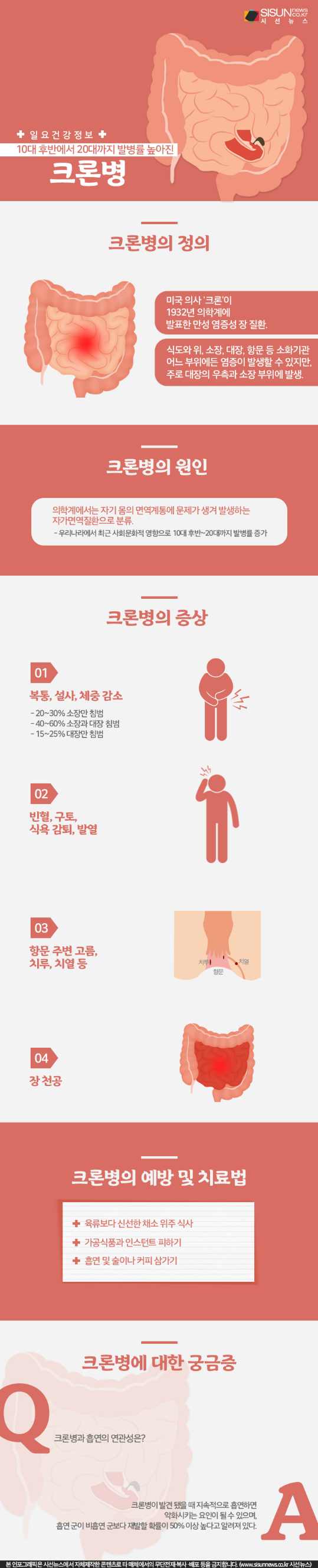 크론병