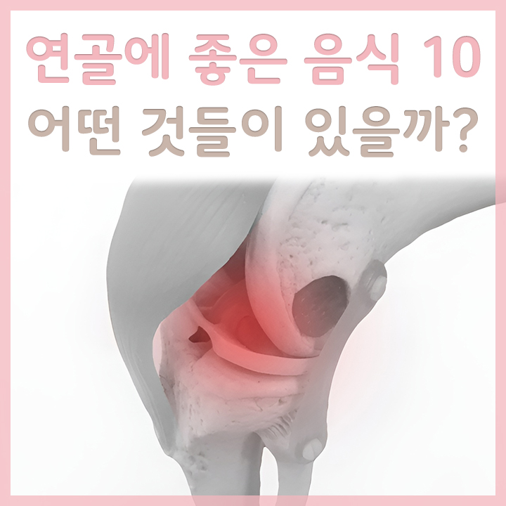 무릎연골-외형