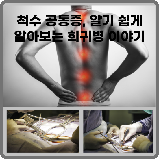 척수 공동증