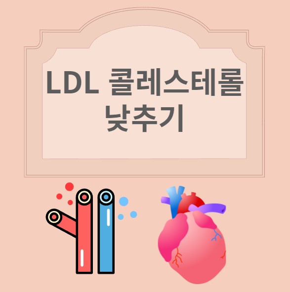 LDL 콜레스테롤 낮추기