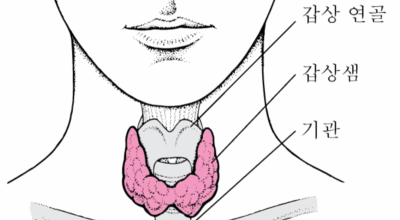 갑상선 이미지