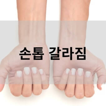 손톱 갈라짐