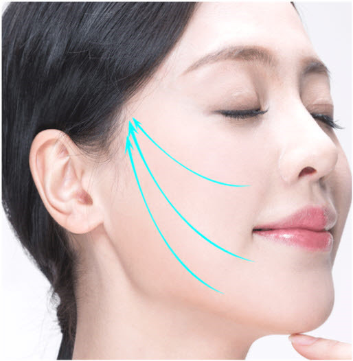 피부과 실리프팅