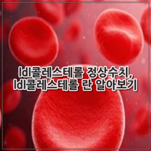 ldl콜레스테롤 정상수치, ldl콜레스테롤 란 알아보기