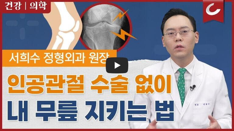 수술 없이 내 무릎 지키는 방법