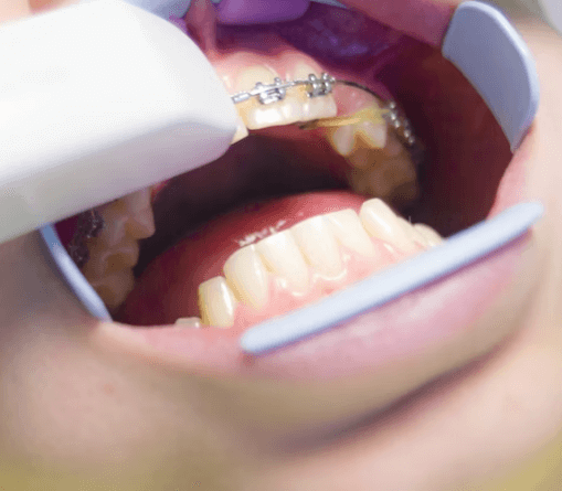 치실 사용법 - 손동작