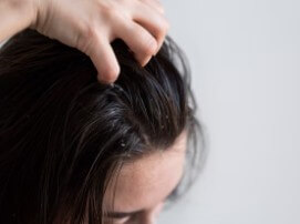 두피열-내리는-법-2