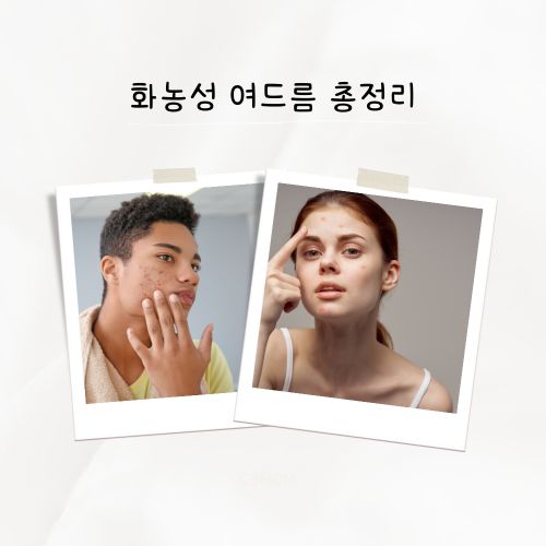 화농성 여드름 원인