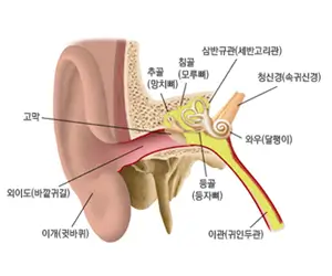 이명 증상