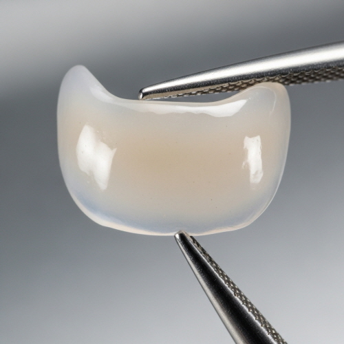 제로네이트 라미네이트 차이