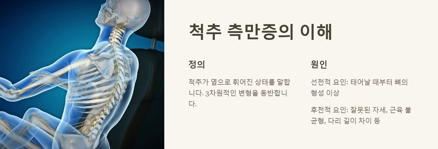 척추 측만증 교정운동