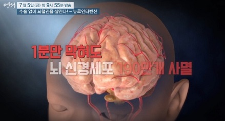 뇌신경세포사멸