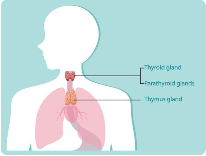 갑상선 기능 항진증에 대해 설명하는 그림