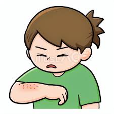 피부발진의 종류