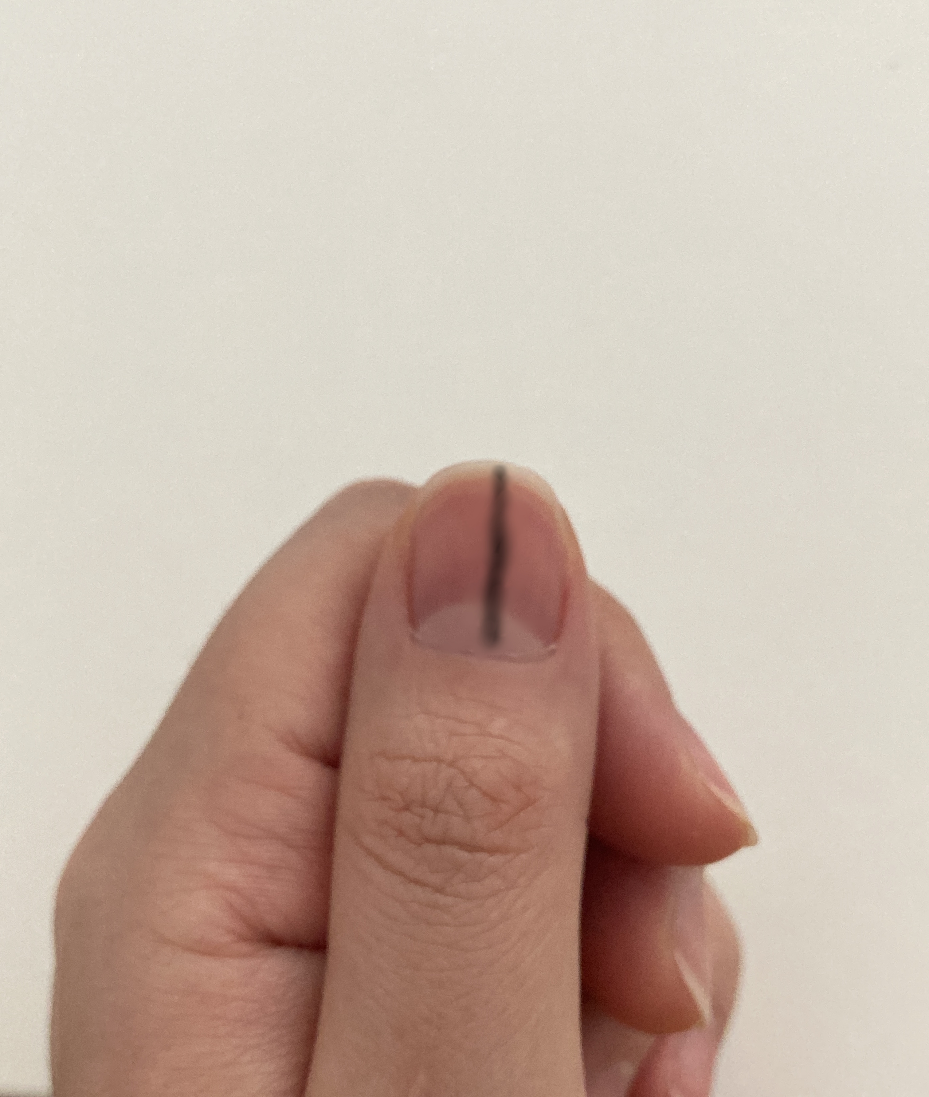 손톱검은세로줄사진