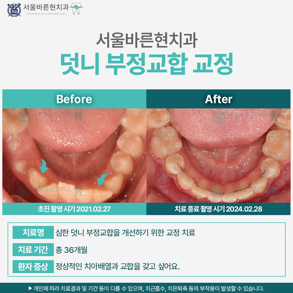 해운대교정치과