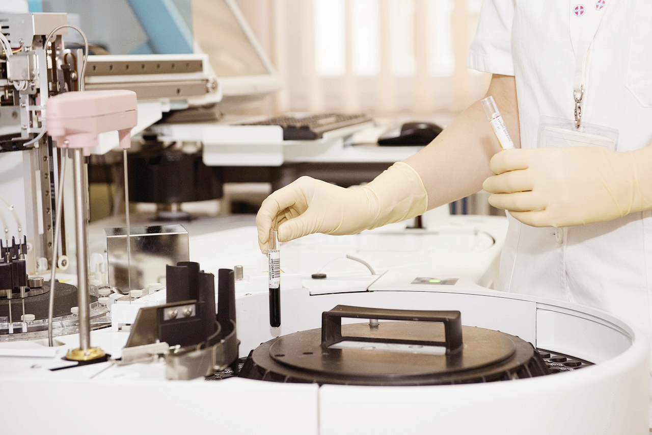 소변검사로 알수있는것