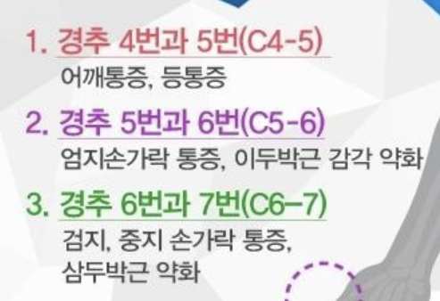 목디스크 2