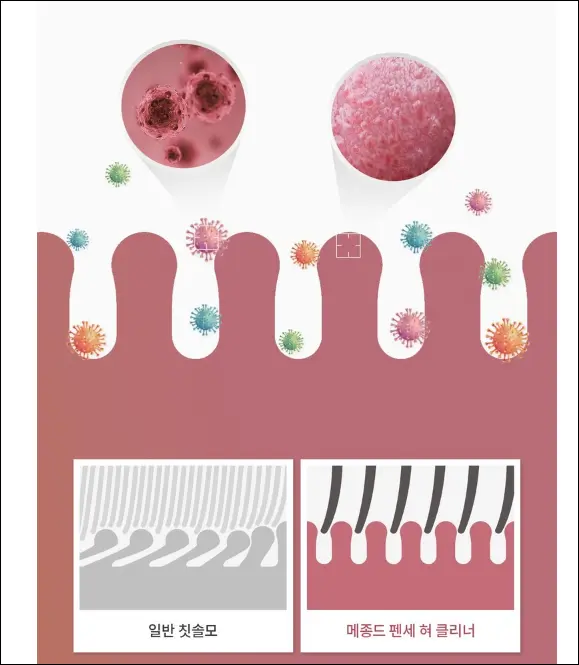 입냄새제거, 혀클리너