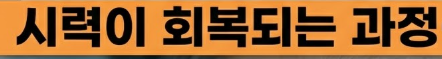 백내장 수술후 시력회복 기간
