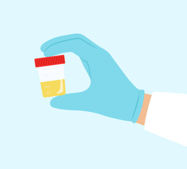 병원에서는 어떤 검사할까 첫번째 소변검사