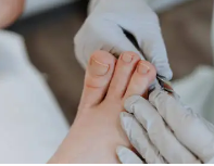 발톱무좀 없애는 방법 18