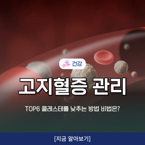 콜레스테롤 관리 방법 알아보기