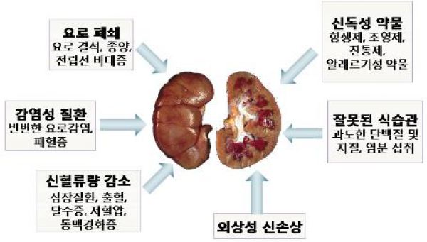 급성 신우신염 증상