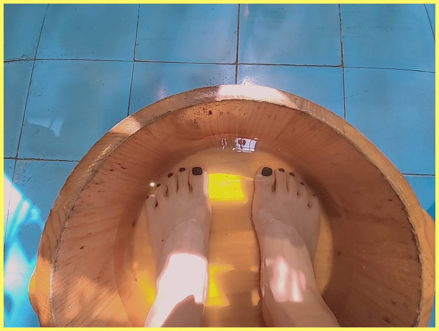 자고 일어났더니 손발이 붓는다? 아침 부종의 원인과 관리법