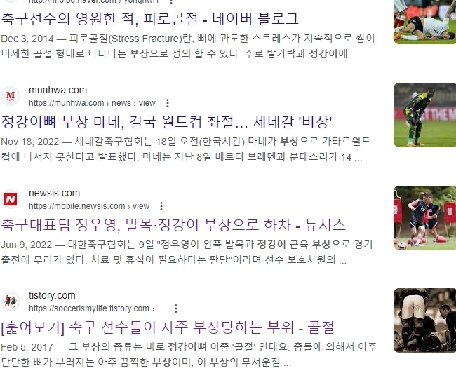 축구 정강이 부상 뉴스 모음
