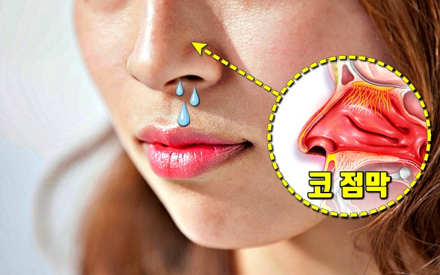 비염에 좋은 음식, 비염 증상