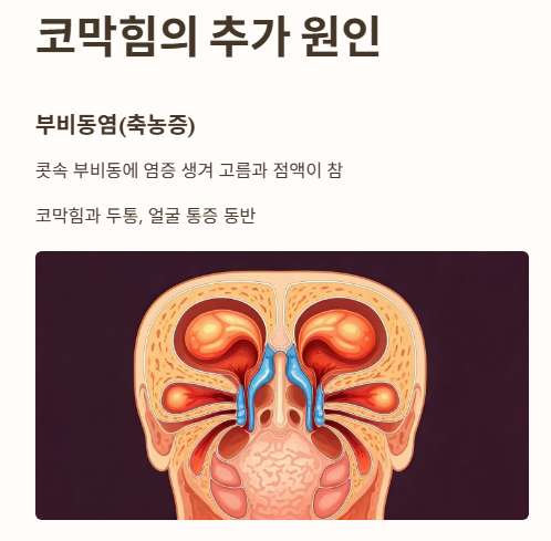 코막힘 원인